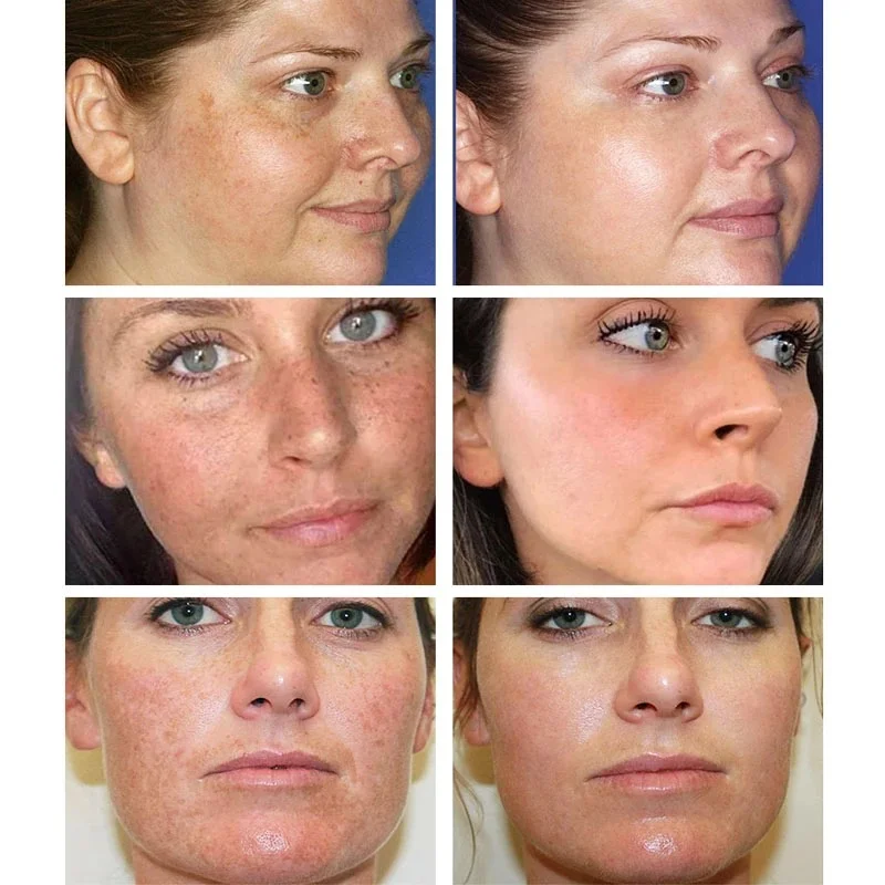 Effective Whitening Freckles C - Licorice Root Sticks ulasan dan harga
