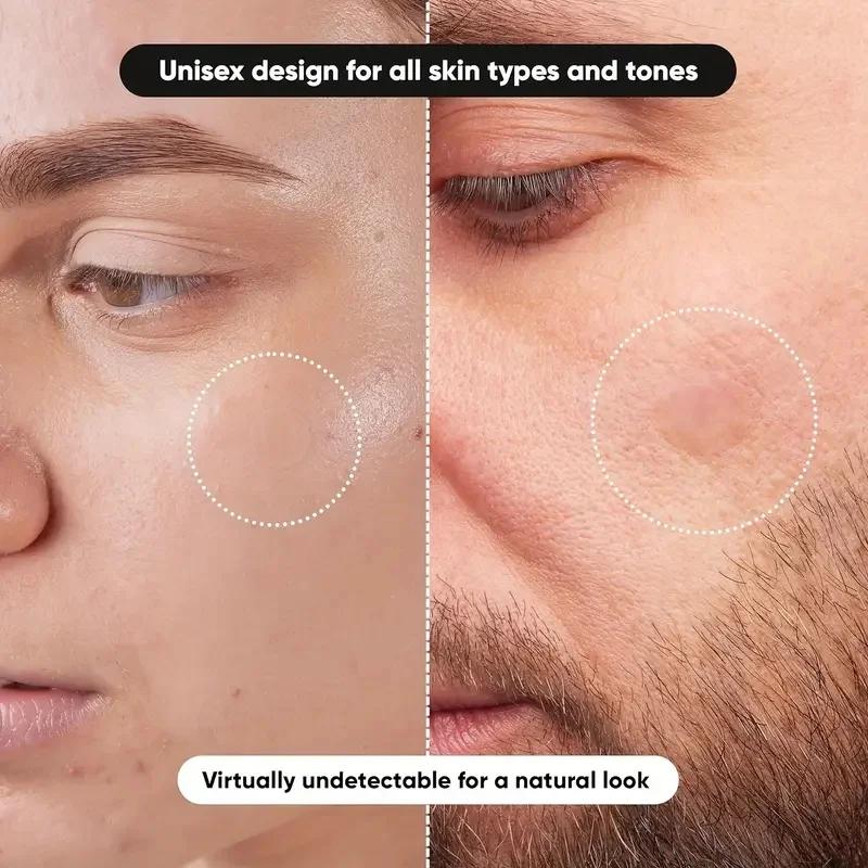 360 pieces/box acne patches -  - Essential Oils ulasan dan harga
